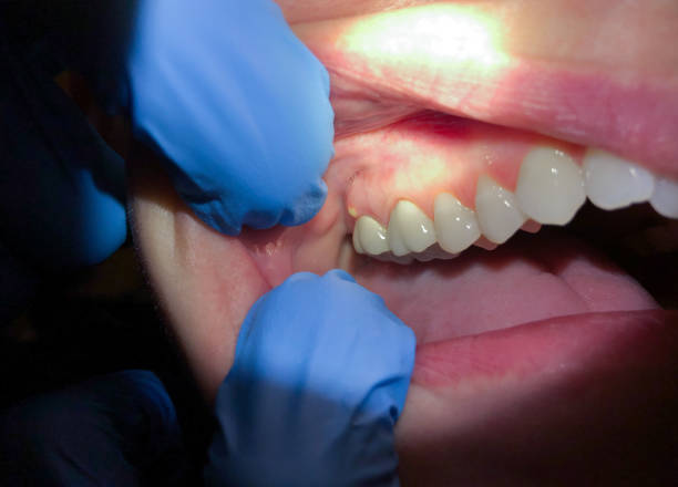 Best Cosmetic Emergency Dentistry in Bay Point, CA